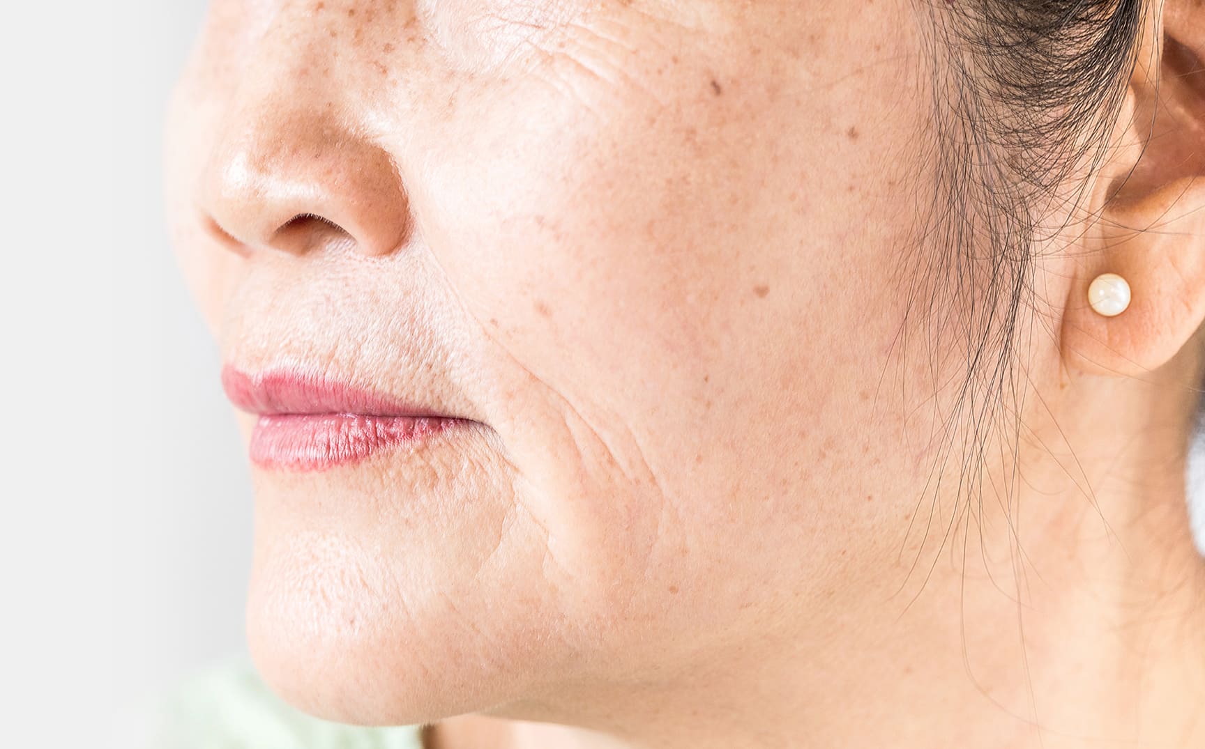 closeup of a womans facial skin in rocklin california