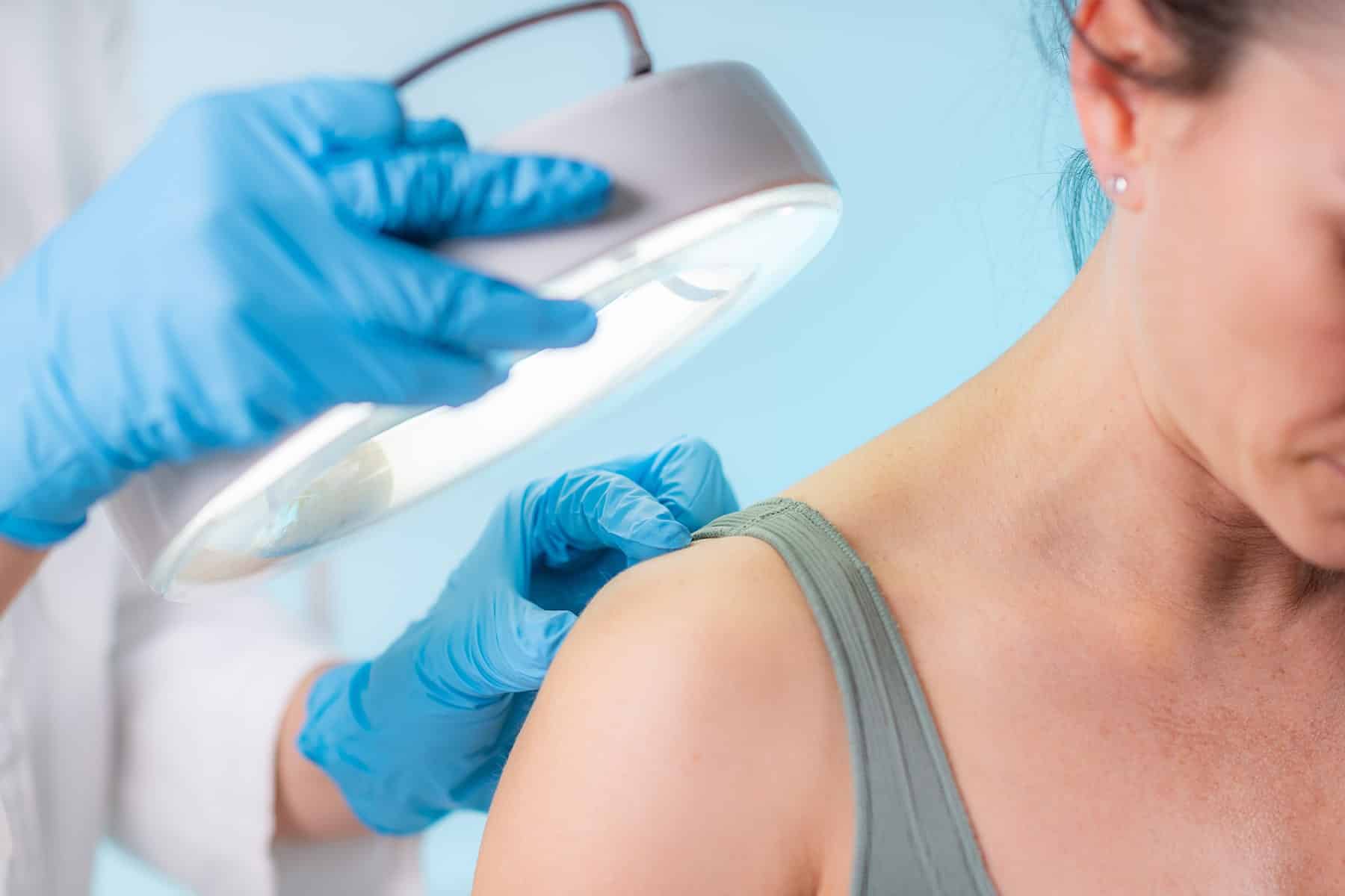 Skin cancer diagnosis in Rocklin, CA