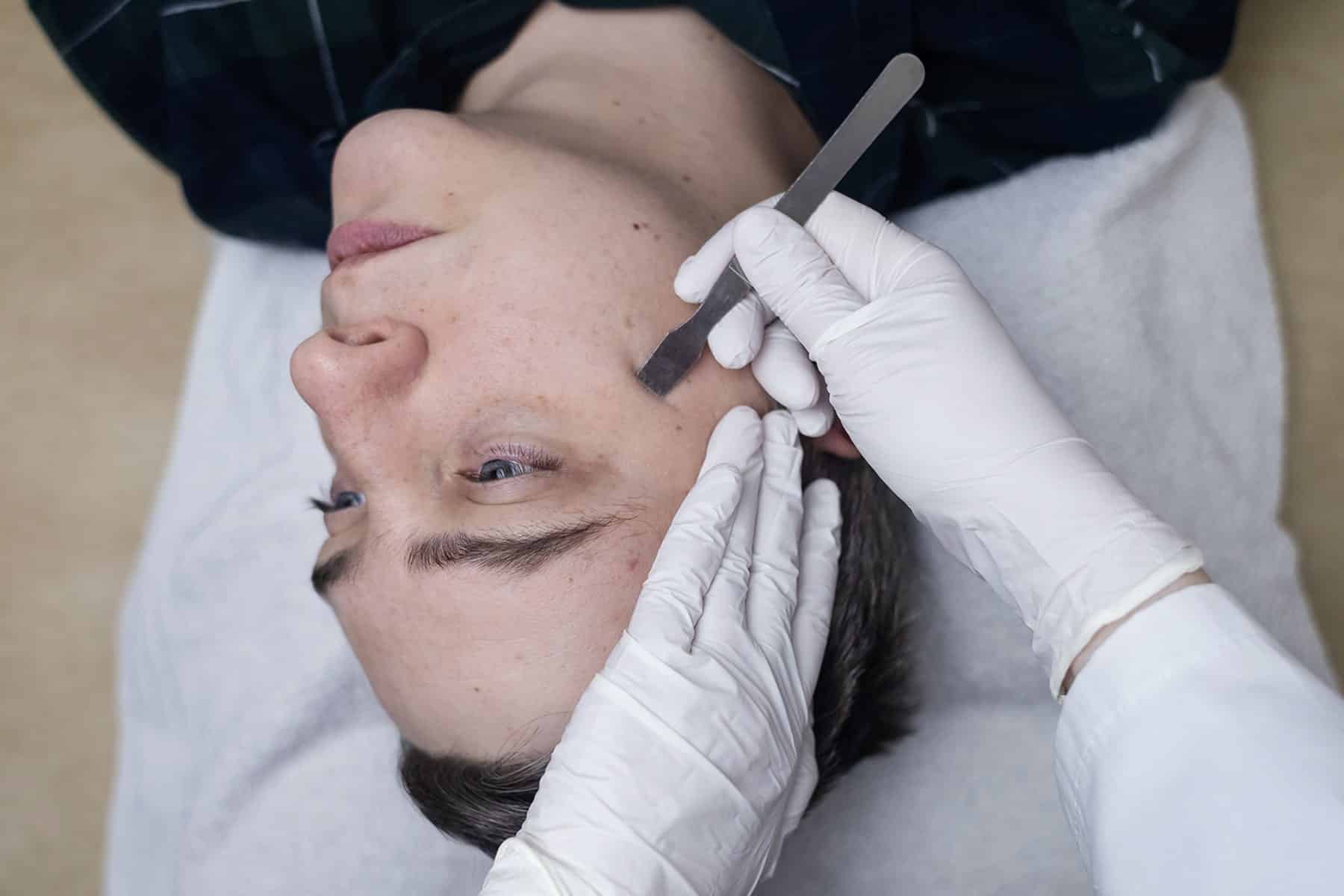 Melanoma doctor in Rocklin, CA