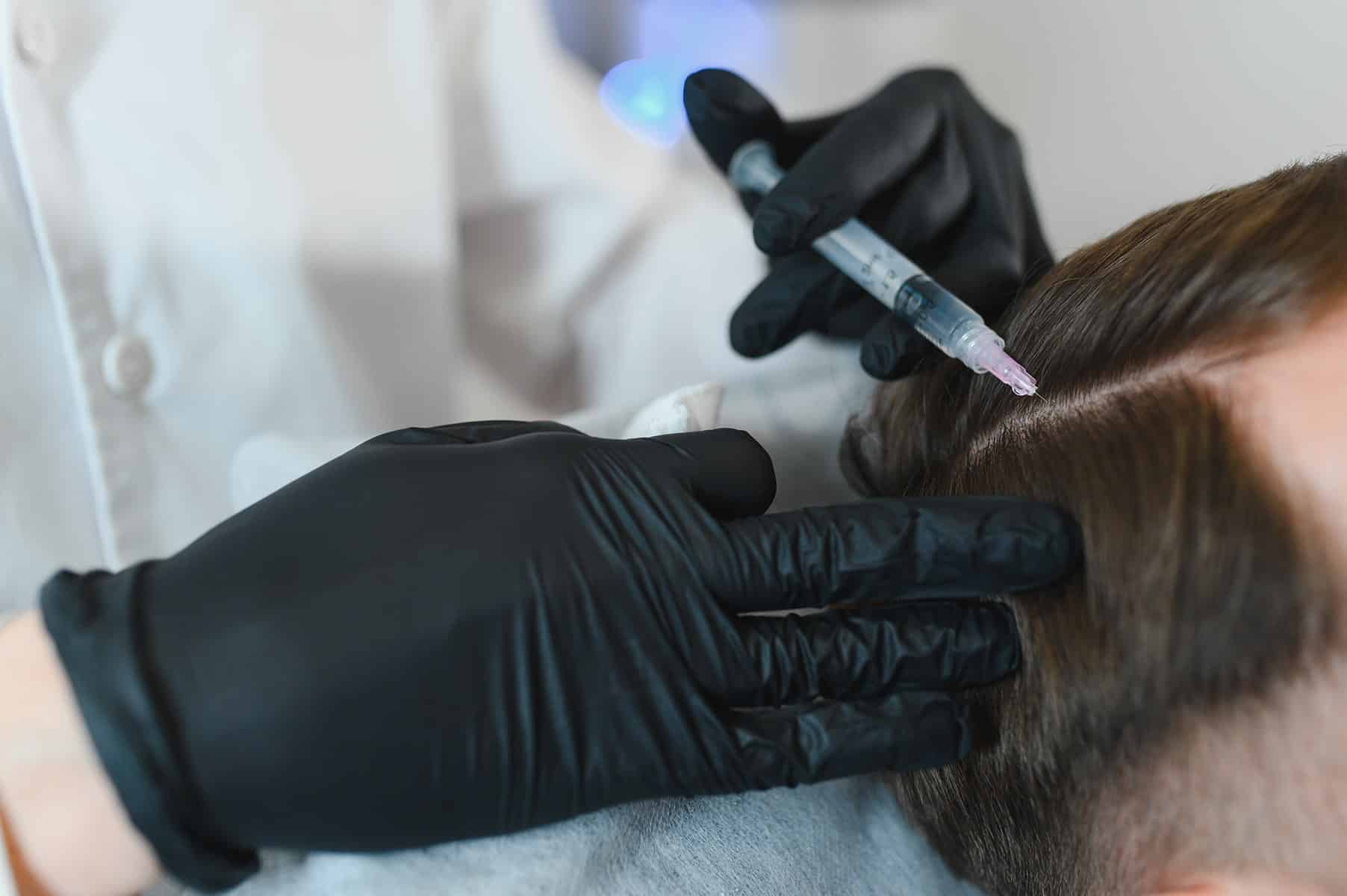 Hair loss doctors appointment in Rocklin, CA