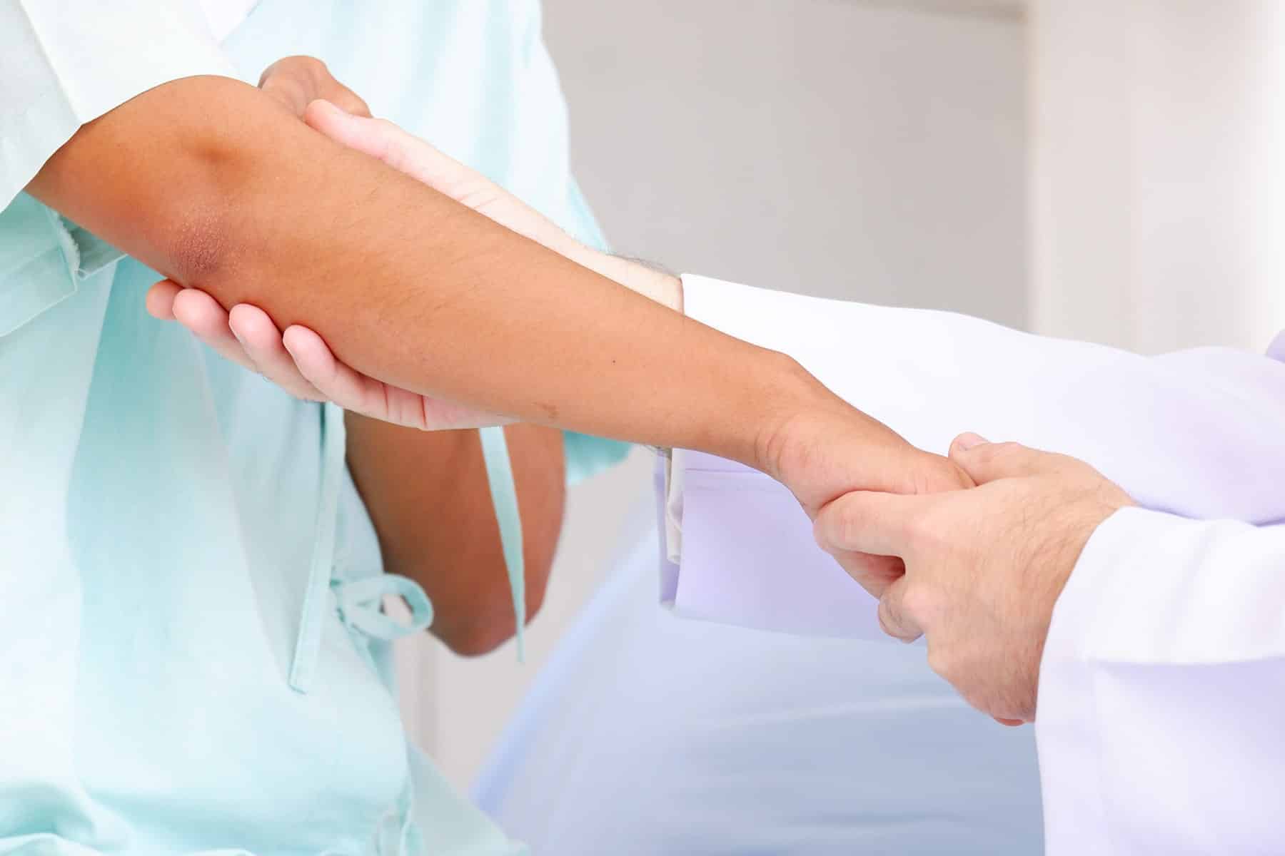 Sweating dermatologist in Rocklin, CA